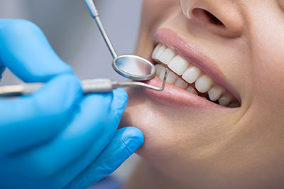 The image shows a dental professional performing a teeth cleaning procedure on a patient, with the patient s mouth open and the dental professional using a specialized tool.