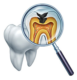 The image is a digital illustration showing a magnified view of a human tooth with the root visible and an internal structure that includes a pulp chamber, nerve endings, and blood vessels. A dental mirror is held up to the tooth, reflecting its interior and highlighting these features. There are no texts present in the image.