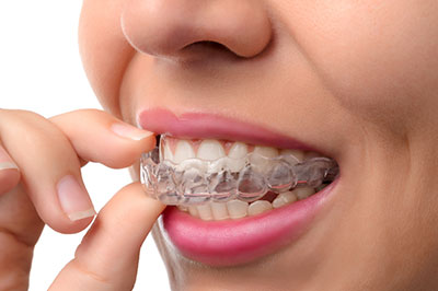 Woman holding a clear plastic tray with her teeth, showing off her smile and dental braces.