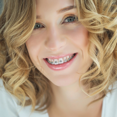 A smiling woman with braces, wearing a white top and curly hair, posing for a portrait.