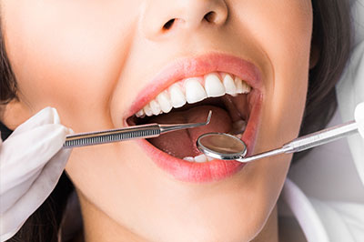 A woman in a dental office, smiling broadly with her mouth open, holding a toothbrush, and wearing a white lab coat.